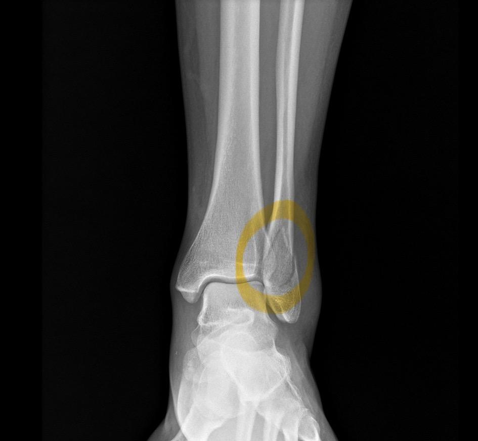 Recovery from Injury